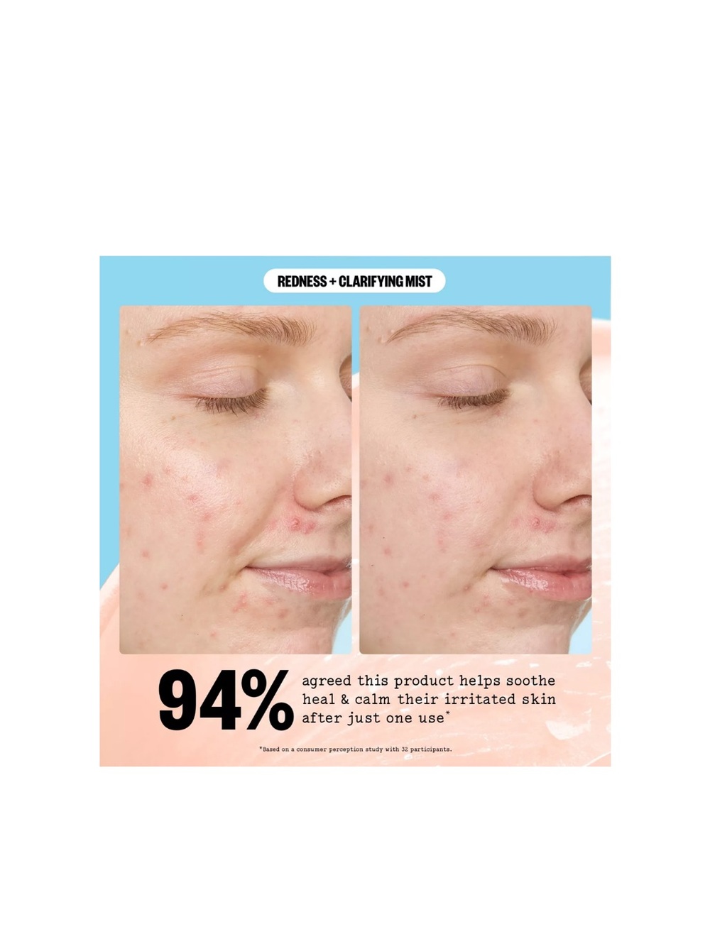 Peace Out Redness Reducing + Clarifying Facial Mist - Picture 8 of 10